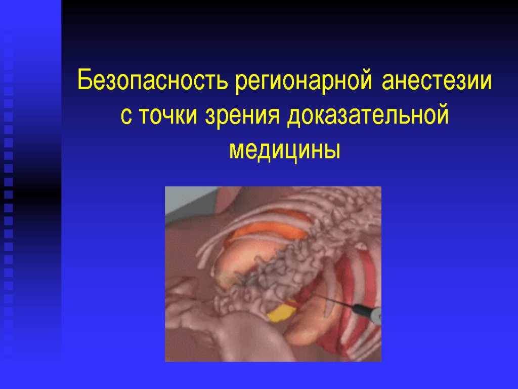 Безопасность регионарной анестезии с точки зрения доказательной медицины